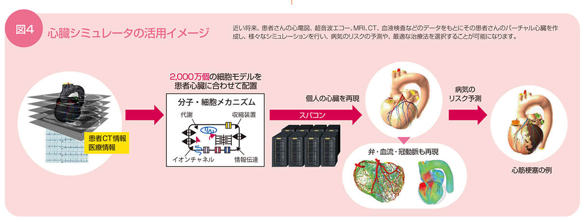 図4 心臓シミュレータの活用イメージ。患者CT情報、医療情報から個人の心臓を再現し、病気のリスク予測等を行う。