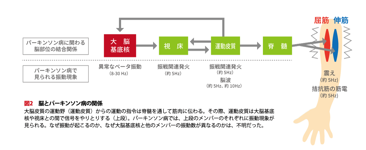 図2 脳とパーキンソン病の関係